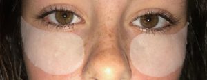 Beauty Spot