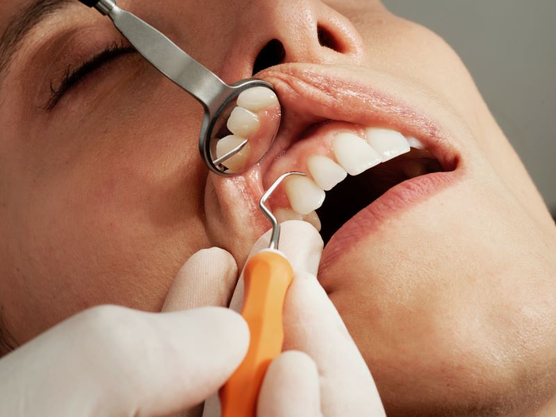 how often should you go for a dental cleaning