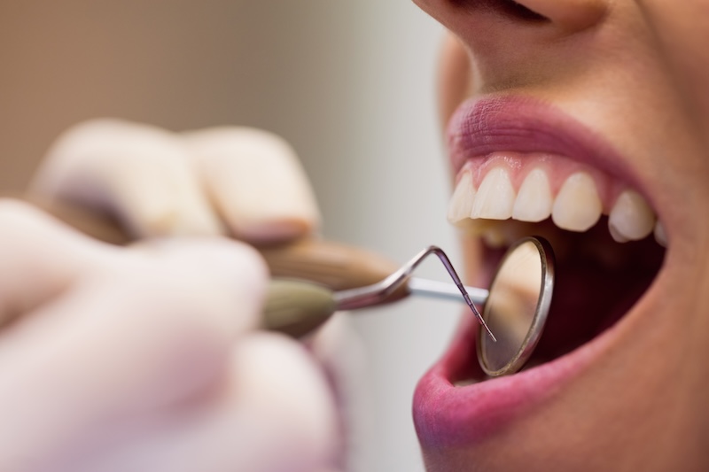 dental insurance for the self-employed
